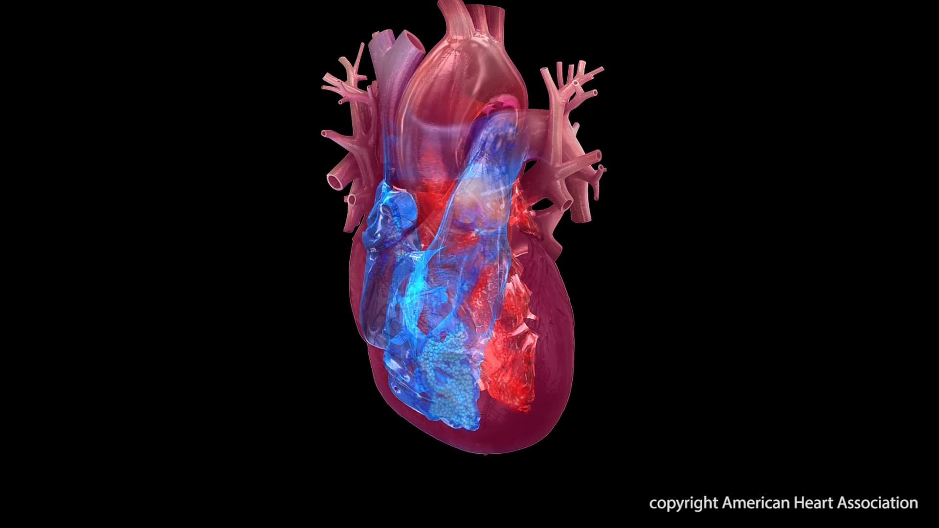 Shift in Heart Disease Deaths Highlights Advances and Emerging Challenges