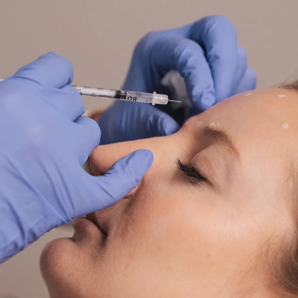 Botox Treatments in Corte Madera Offer Multiple Benefits Beyond Wrinkle Reduction